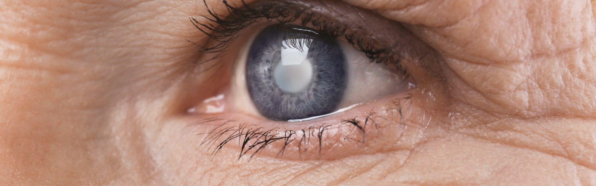 Αίτια, συμπτώματα και θεραπεία για τους όγκους του κόγχου στα μάτια