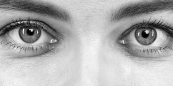 Dark Circles