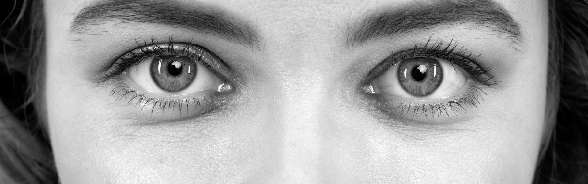 Dark Circles 1 Dark Circles