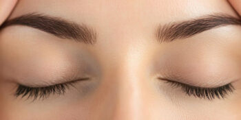 Brow lift