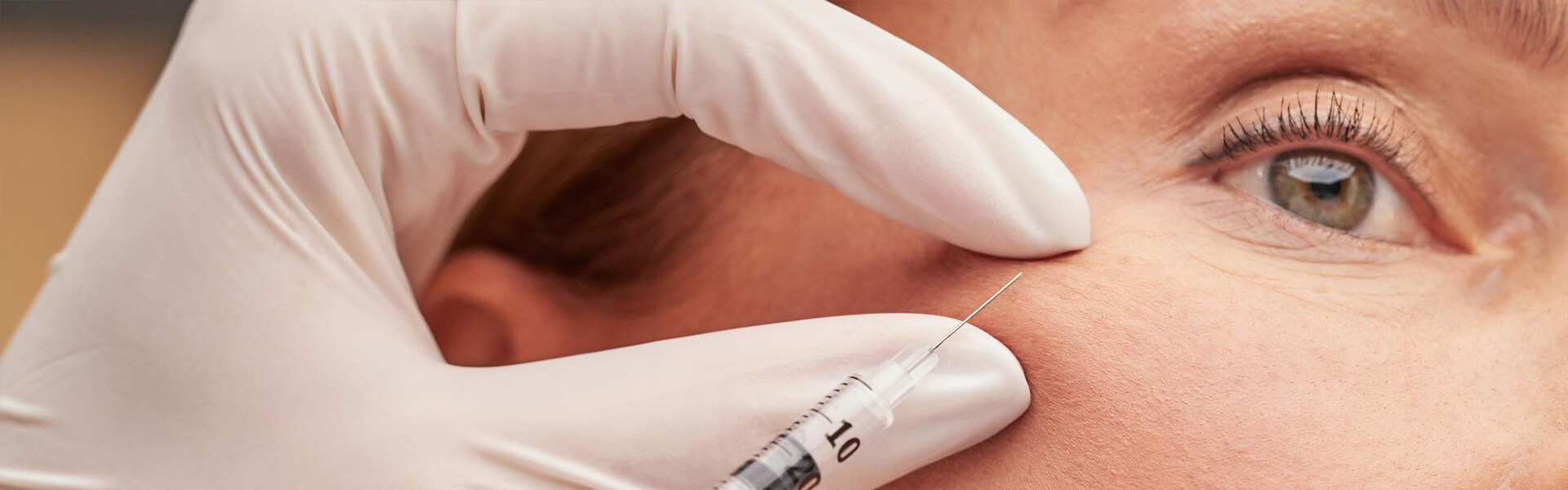 Restylane® treatment Aesthetic ophtalmology