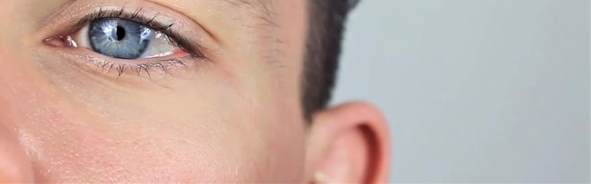 Nasolacrimal duct obstruction