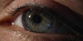 Watery eye