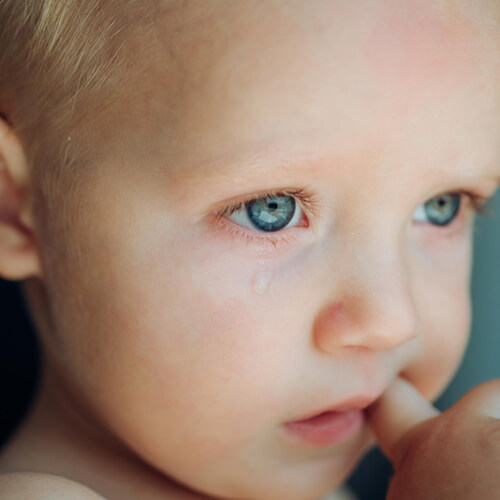 Watery eyes in children