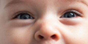 Watery eyes in children