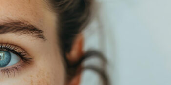 Facial palsy