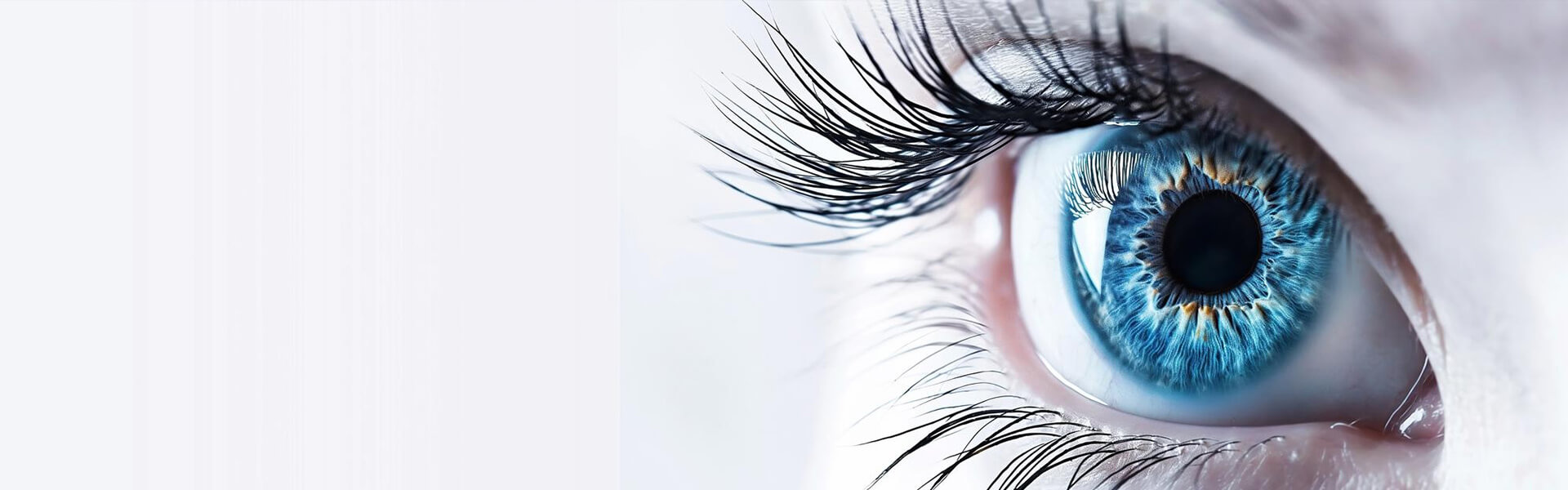 Trichiasis 1 Trichiasis - Causes, Symptoms & Treatment