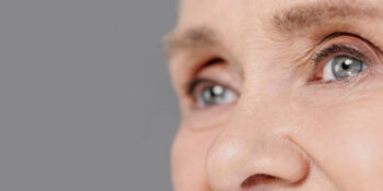 Blepharospasm